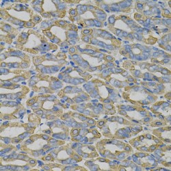 Zinc Finger Protein RFP (TRIM27) Antibody