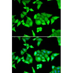 Zinc Finger Protein RFP (TRIM27) Antibody