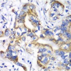 Ribosomal Protein L9 (RPL9) Antibody