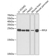 Western blot analysis of extracts of various cell lines, using RPL9 antibody (abx004900) at 1/1000 dilution.