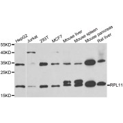 Western blot analysis of extracts of various cell lines, using RPL11 antibody (abx004901) at 1/1000 dilution.