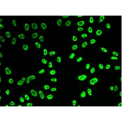 U1 Small Nuclear Ribonucleoprotein A (SNRPA) Antibody