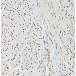 U1 Small Nuclear Ribonucleoprotein A (SNRPA) Antibody