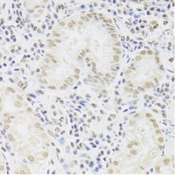 U1 Small Nuclear Ribonucleoprotein A (SNRPA) Antibody