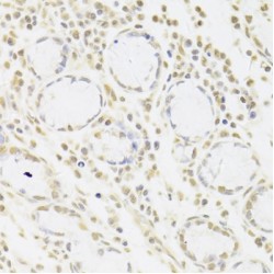 U1 Small Nuclear Ribonucleoprotein A (SNRPA) Antibody