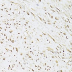 U1 Small Nuclear Ribonucleoprotein A (SNRPA) Antibody