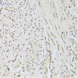 U1 Small Nuclear Ribonucleoprotein A (SNRPA) Antibody