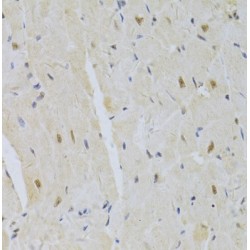 U1 Small Nuclear Ribonucleoprotein A (SNRPA) Antibody