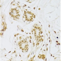 U1 Small Nuclear Ribonucleoprotein A (SNRPA) Antibody