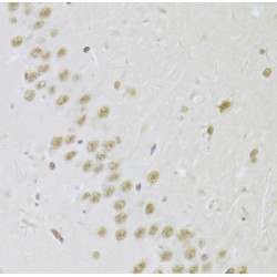 U1 Small Nuclear Ribonucleoprotein A (SNRPA) Antibody