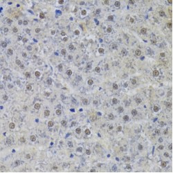 U1 Small Nuclear Ribonucleoprotein A (SNRPA) Antibody