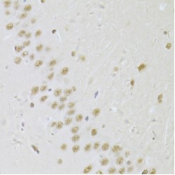 U1 Small Nuclear Ribonucleoprotein A (SNRPA) Antibody