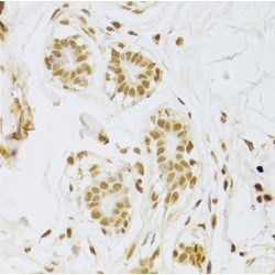 U1 Small Nuclear Ribonucleoprotein A (SNRPA) Antibody