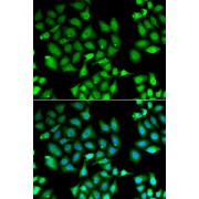 Immunofluorescence analysis of A549 cells using KLF10 antibody (abx004909). Blue: DAPI for nuclear staining.