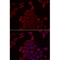 Pyruvate Dehydrogenase Complex Component X (PDHX) Antibody