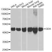 Western blot analysis of extracts of various cell lines, using GDA Antibody (abx004934) at 1/1000 dilution.