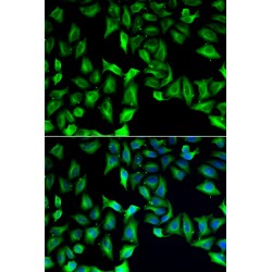 Guanine Deaminase (GDA) Antibody