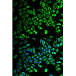 Dimethylarginine Dimethylaminohydrolase 2 (DDAH2) Antibody