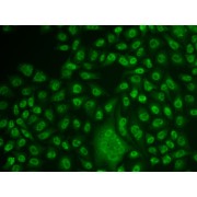 Immunofluorescence analysis of U2OS cells using TFPT antibody (abx004953).