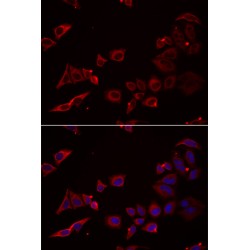 Nuclear Receptor Binding Factor 2 (NRBF2) Antibody