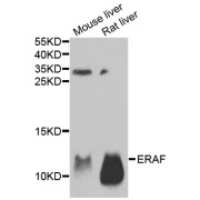 Western blot analysis of extracts of various cell lines, using AHSP antibody (abx004956) at 1/1000 dilution.