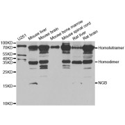 Western blot analysis of extracts of various cell lines, using NGB antibody (abx004965) at 1/1000 dilution.