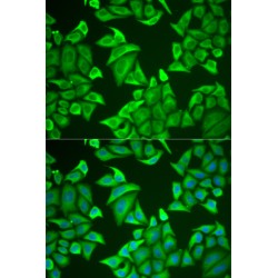 Neuroglobin (NGB) Antibody