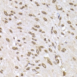 Lamin-B2 (LMNB2) Antibody