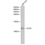 Western blot analysis of extracts of rat skin, using UCN2 antibody (abx004972) at 1/1000 dilution.