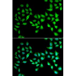 Urocortin-2 (UCN2) Antibody