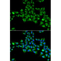 Cytoglobin (CYGB) Antibody