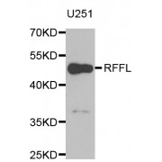 Western blot analysis of extracts of U-251MG cells, using RFFL antibody (abx004976) at 1/1000 dilution.