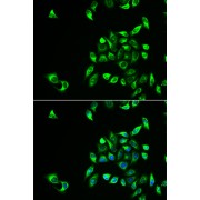 Immunofluorescence analysis of HeLa cells using CSNK1A1L antibody (abx004977). Blue: DAPI for nuclear staining.