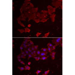 Folliculin (FLCN) Antibody