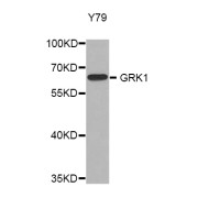 Western blot analysis of extracts of Y79 cells, using GRK1 antibody (abx004981).