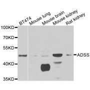 Western blot analysis of extracts of various cell lines, using ADSS antibody (abx004996) at 1/1000 dilution.