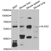 Western blot analysis of extracts of various cell lines, using ALAS2 antibody (abx005002) at 1/1000 dilution.