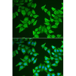 5-Aminolevulinate Synthase, Erythroid-Specific, Mitochondrial (ALAS2) Antibody