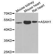 Western blot analysis of extracts of various cell lines, using ASAH1 antibody (abx005006) at 1/1000 dilution.