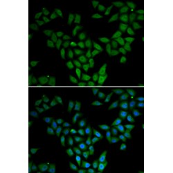 Histone Chaperone ASF1A (ASF1A) Antibody