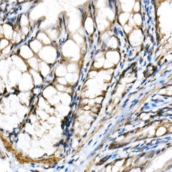 Class E Basic Helix-Loop-Helix Protein 40 (BHLHE40) Antibody