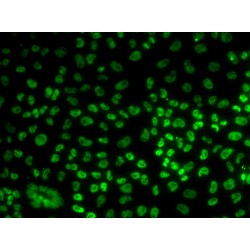 Mitotic Checkpoint Protein BUB3 (BUB3) Antibody