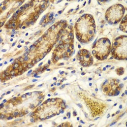 Calpain Small Subunit 1 (CAPNS1) Antibody