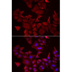 Caspase 14 (CASP14) Antibody