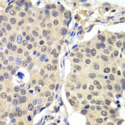 Cyclin-C (CCNC) Antibody