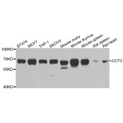 Western blot analysis of extracts of various cell lines, using CCT3 antibody (abx005025) at 1/1000 dilution.