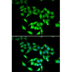 T-Complex Protein 1 Subunit Gamma (CCT3) Antibody