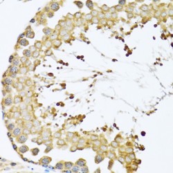 T-Complex Protein 1 Subunit Delta (CCT4) Antibody