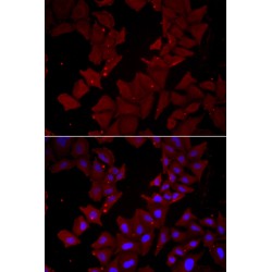 T-Complex Protein 1 Subunit Delta (CCT4) Antibody