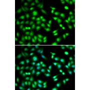 Immunofluorescence analysis of HeLa cells using CDKN2D antibody (abx005030). Blue: DAPI for nuclear staining.